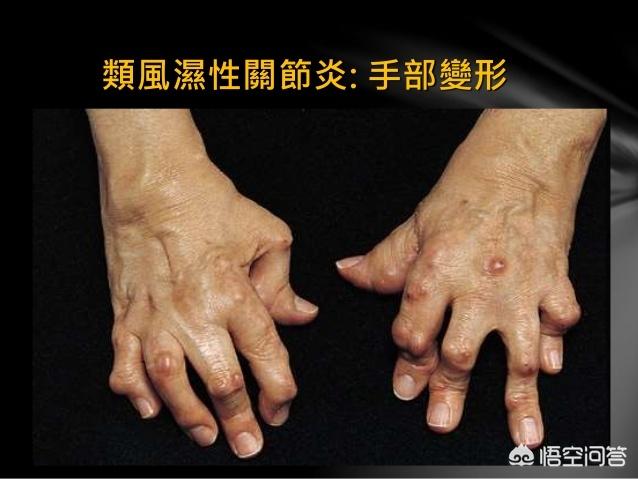 堂口立多了有什么症状(立堂口之后会看见什么)